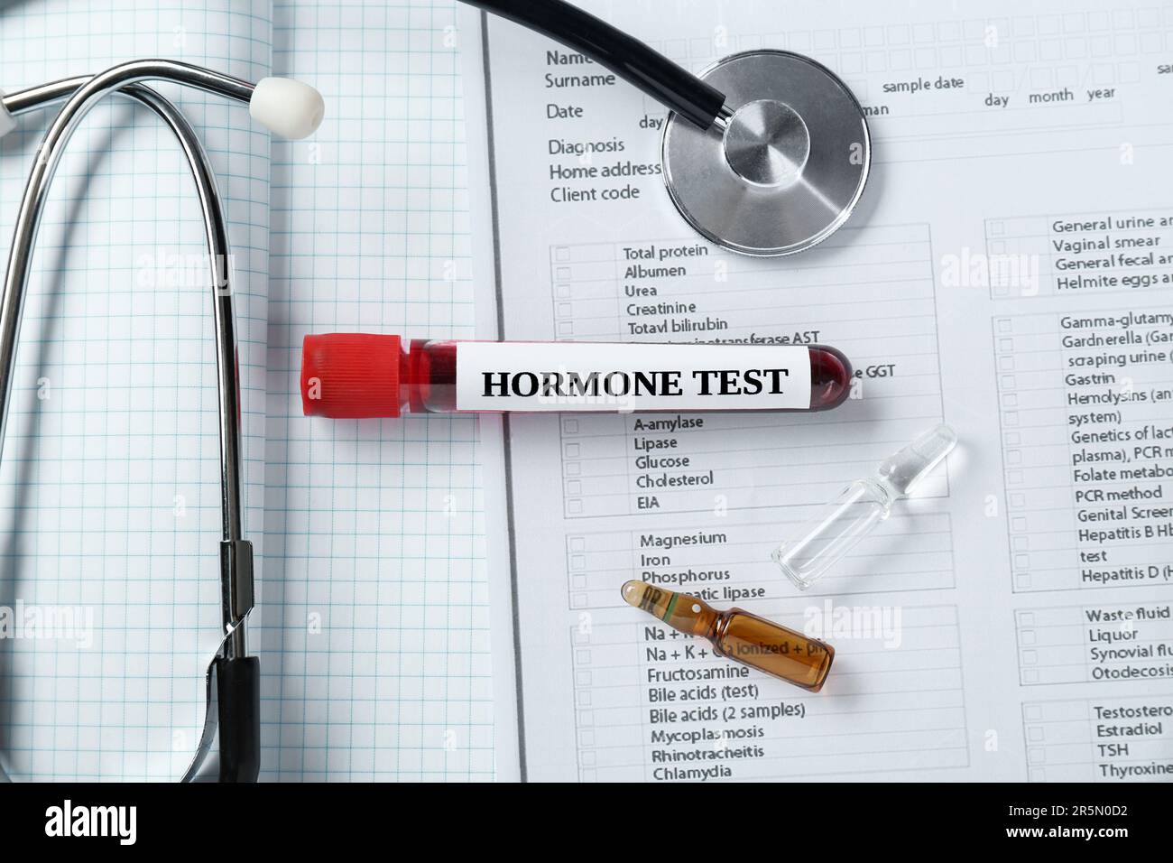Glasröhrchen mit Blutprobe mit Etikett Hormone Test und Stethoskop auf Notebook, flach liegend Stockfoto