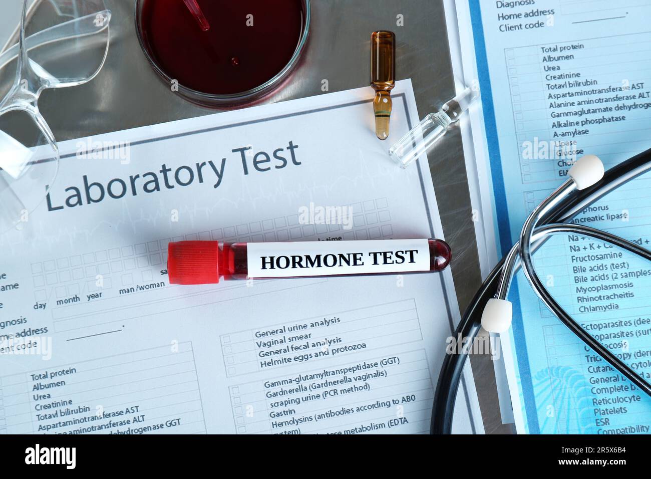 Glasröhrchen mit Blutprobe und Etikett Hormone Test auf einem Metalltisch, flach liegend Stockfoto