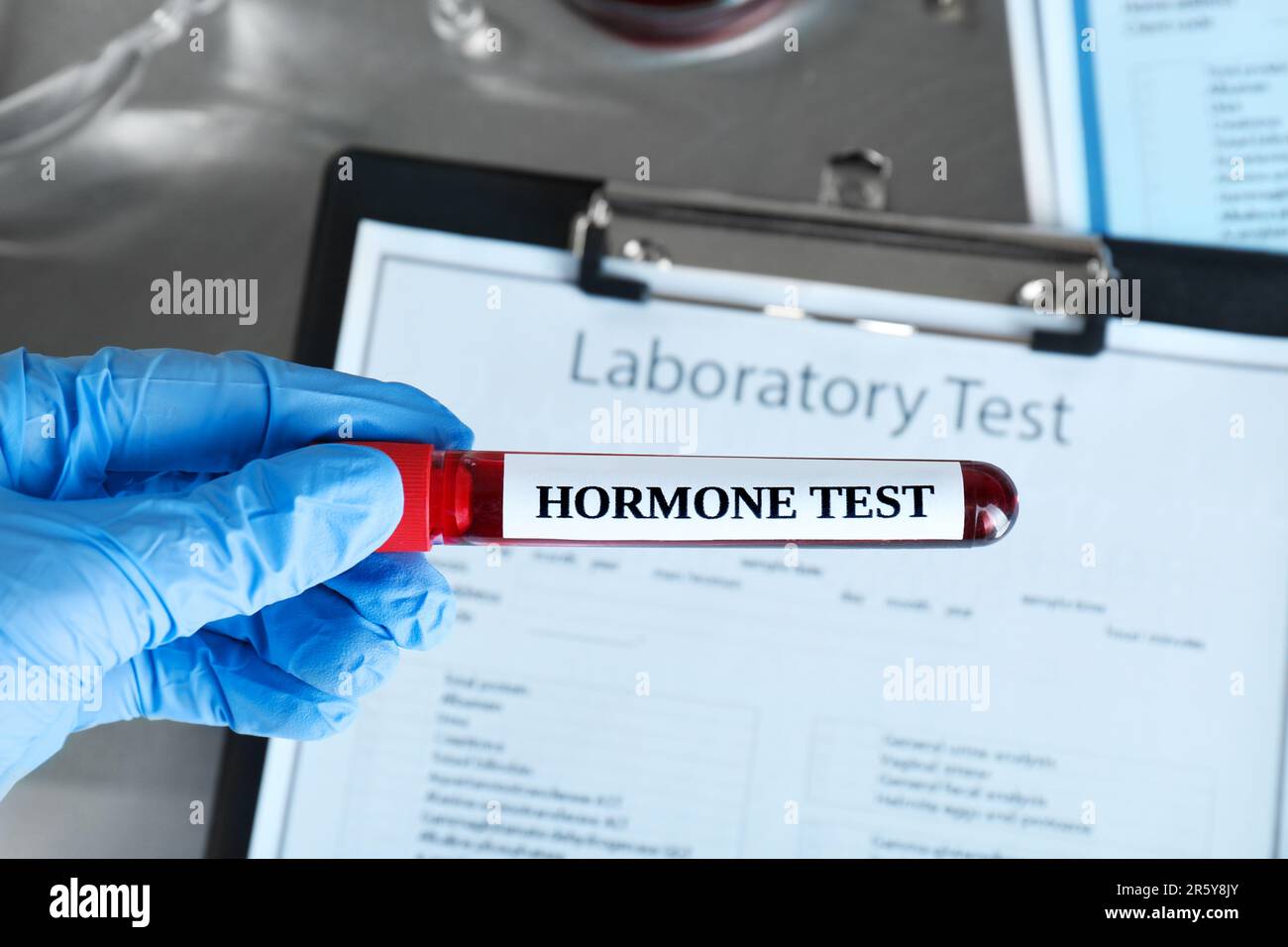 Arzt, der das Glasröhrchen mit der Blutprobe hält, und Etikett Hormone Test at table, close-up Stockfoto