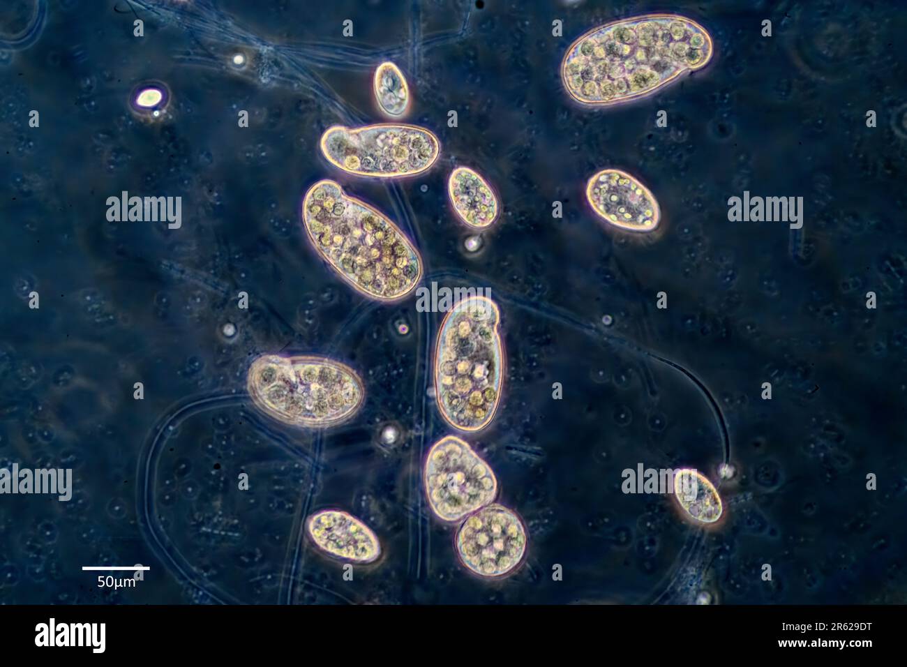 Ziliate aus dem Geneus Colpidium (möglicherweise C. Colpoda). Foto einer Süßwasserkultur aus Flusswasser aus Südwesten Norwegens. Bitte beachten Stockfoto