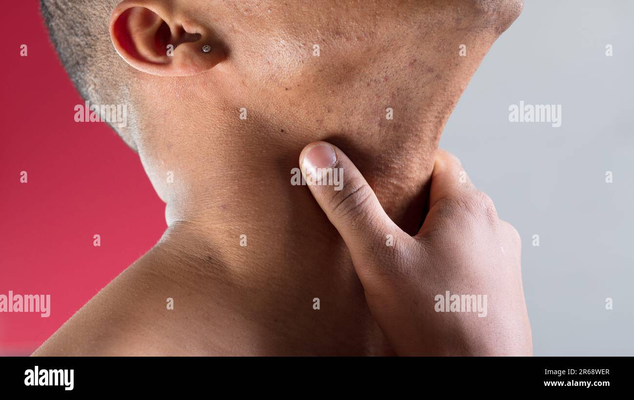 Diese Rasur ist nicht perfekt, was?“ Sagt ein Mann, der die Haut seines angehobenen Nackens spürt. Wir sehen einen Ohrring, ein paar Pickel, einen rasierten Kopf und einen burgunderfarbenen Bac Stockfoto