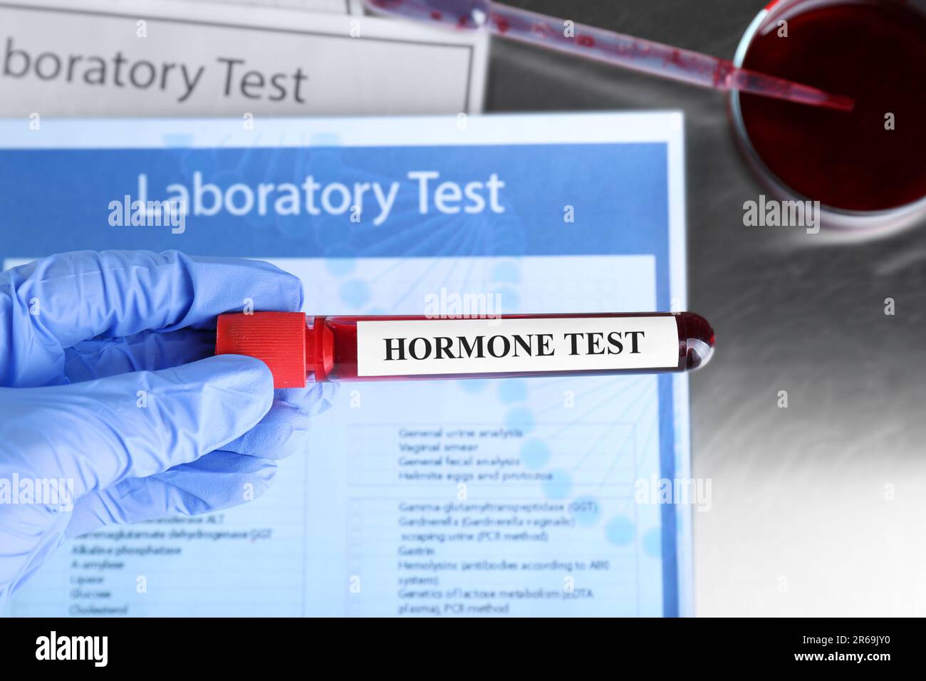 Arzt hält Glasröhrchen mit Blutprobe und Etikett Hormone Test am Tisch, Draufsicht Stockfoto