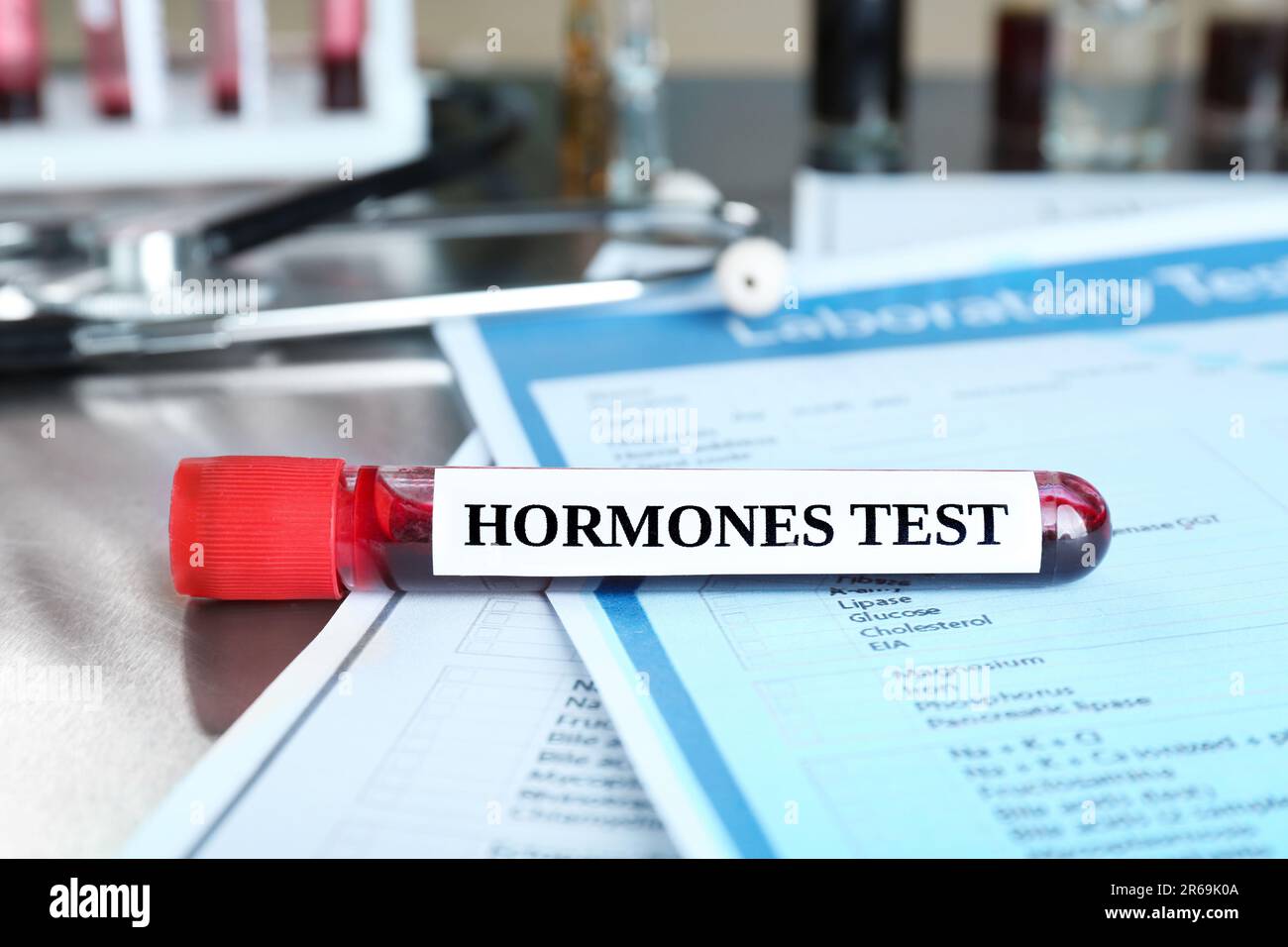Glasröhrchen mit Blutprobe und Etikett Hormone Test auf einem Metalltisch Stockfoto