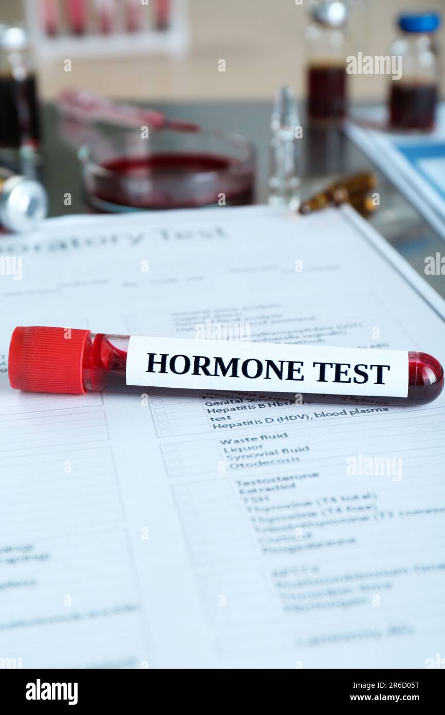 Glasröhrchen mit Blutprobe und Markierung Hormone Test am Tisch Stockfoto