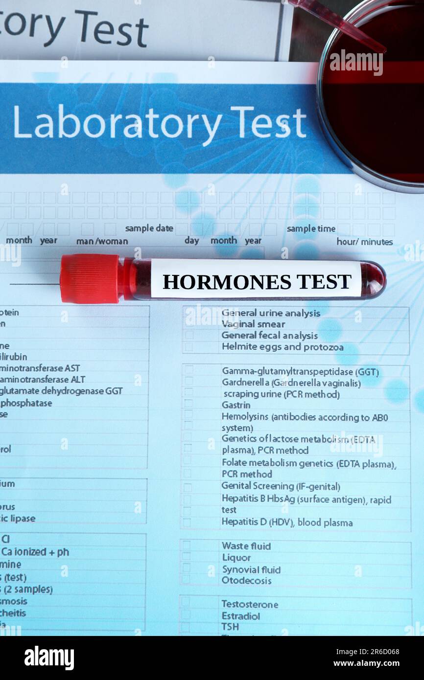 Glasröhrchen mit Blutprobe und Etikett Hormone Test in Laborform, flach liegend Stockfoto