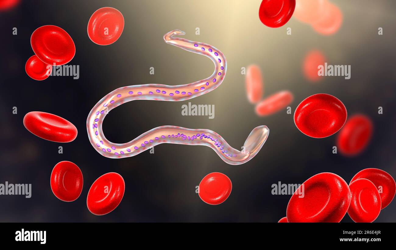 Wuchereria bancrofti. Computer Abbildung des microfilaria Larvenstadium