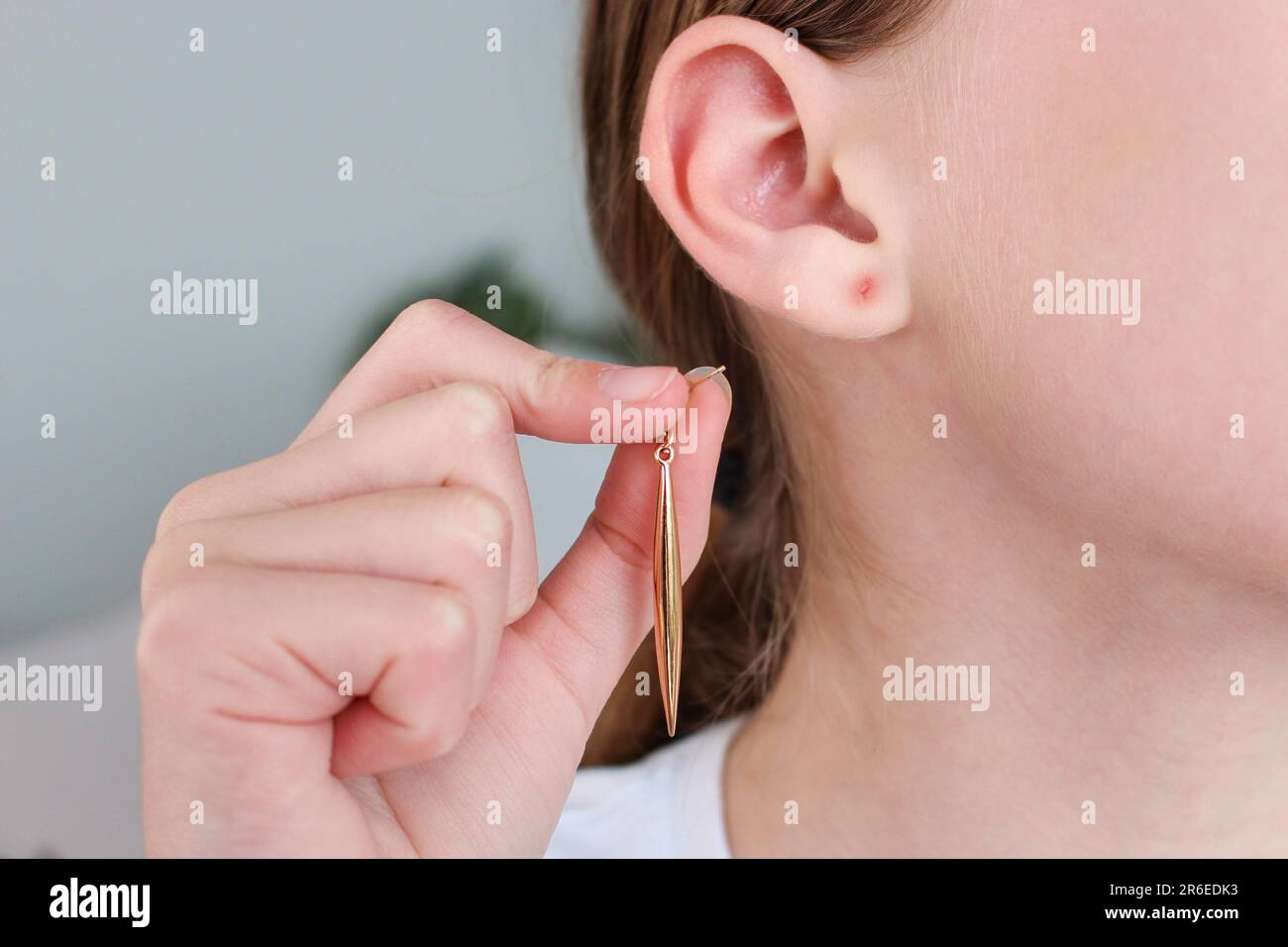Der Teenager riss sich seinen Ohrläppchen mit einem Ohrring ab. Die Wunde am Ohr. Stockfoto