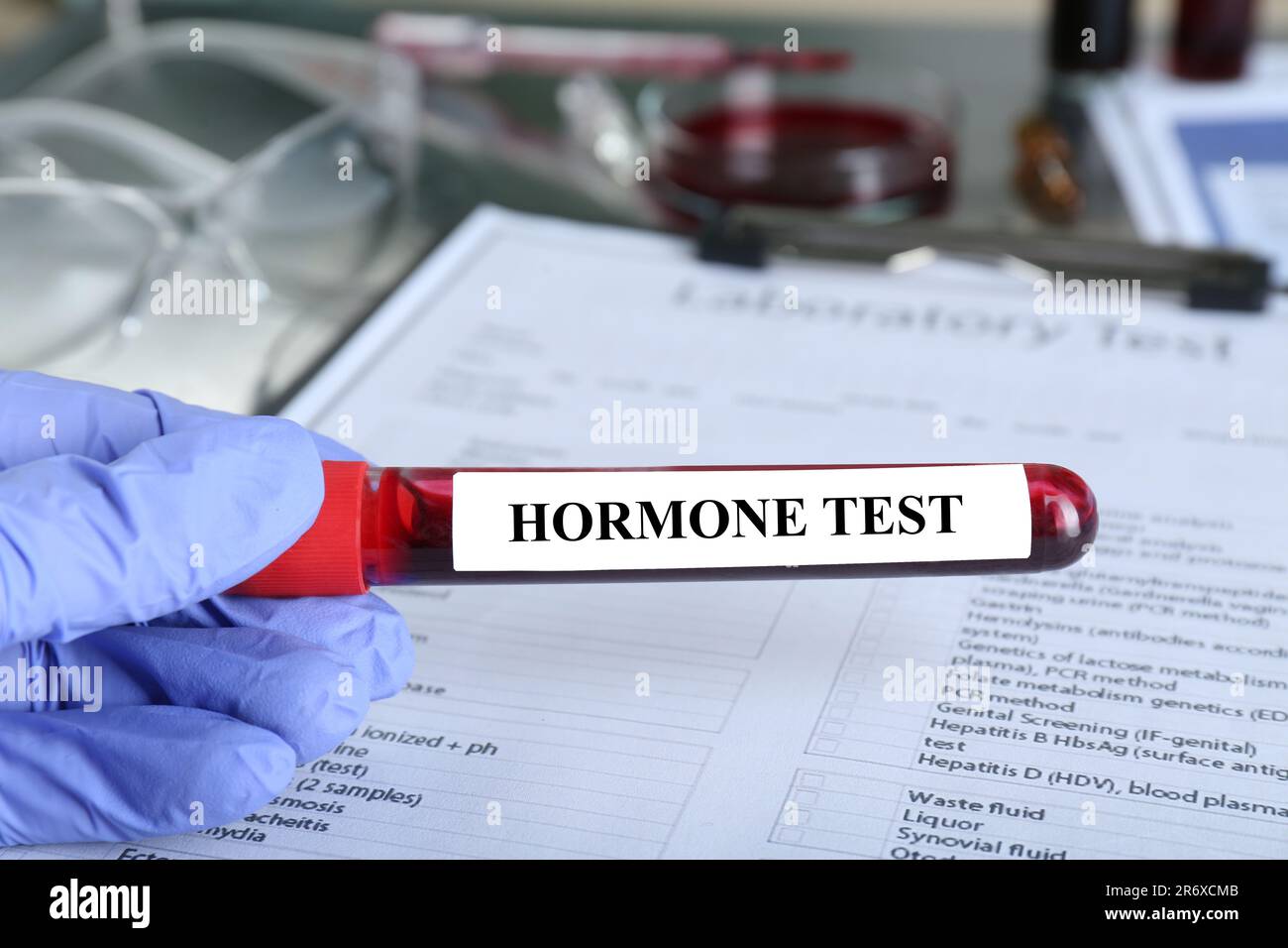 Arzt, der das Glasröhrchen mit der Blutprobe hält, und Etikett Hormone Test at table, close-up Stockfoto