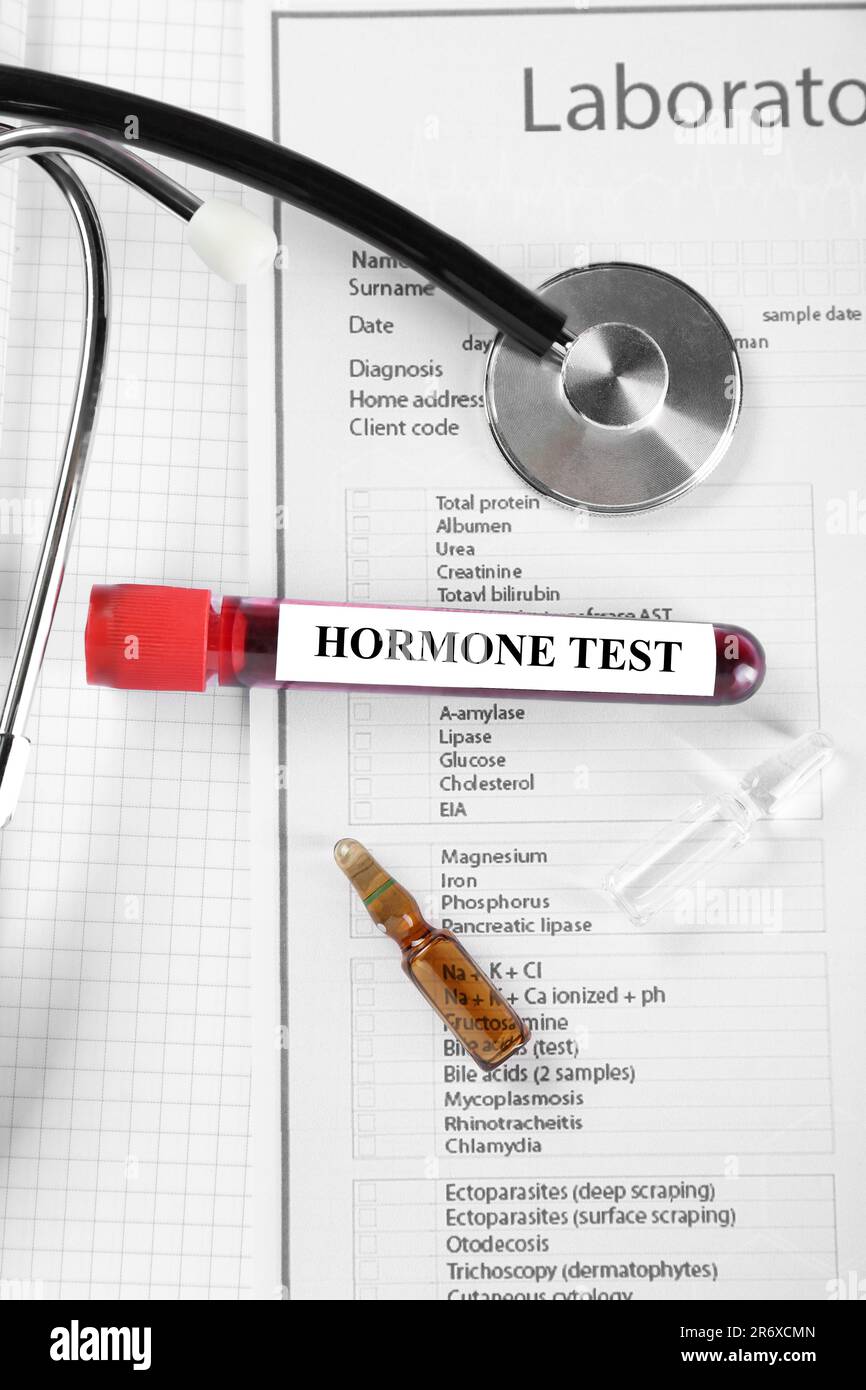 Glasröhrchen mit Blutprobe mit Etikett Hormone Test und Stethoskop auf Notebook, flach liegend Stockfoto