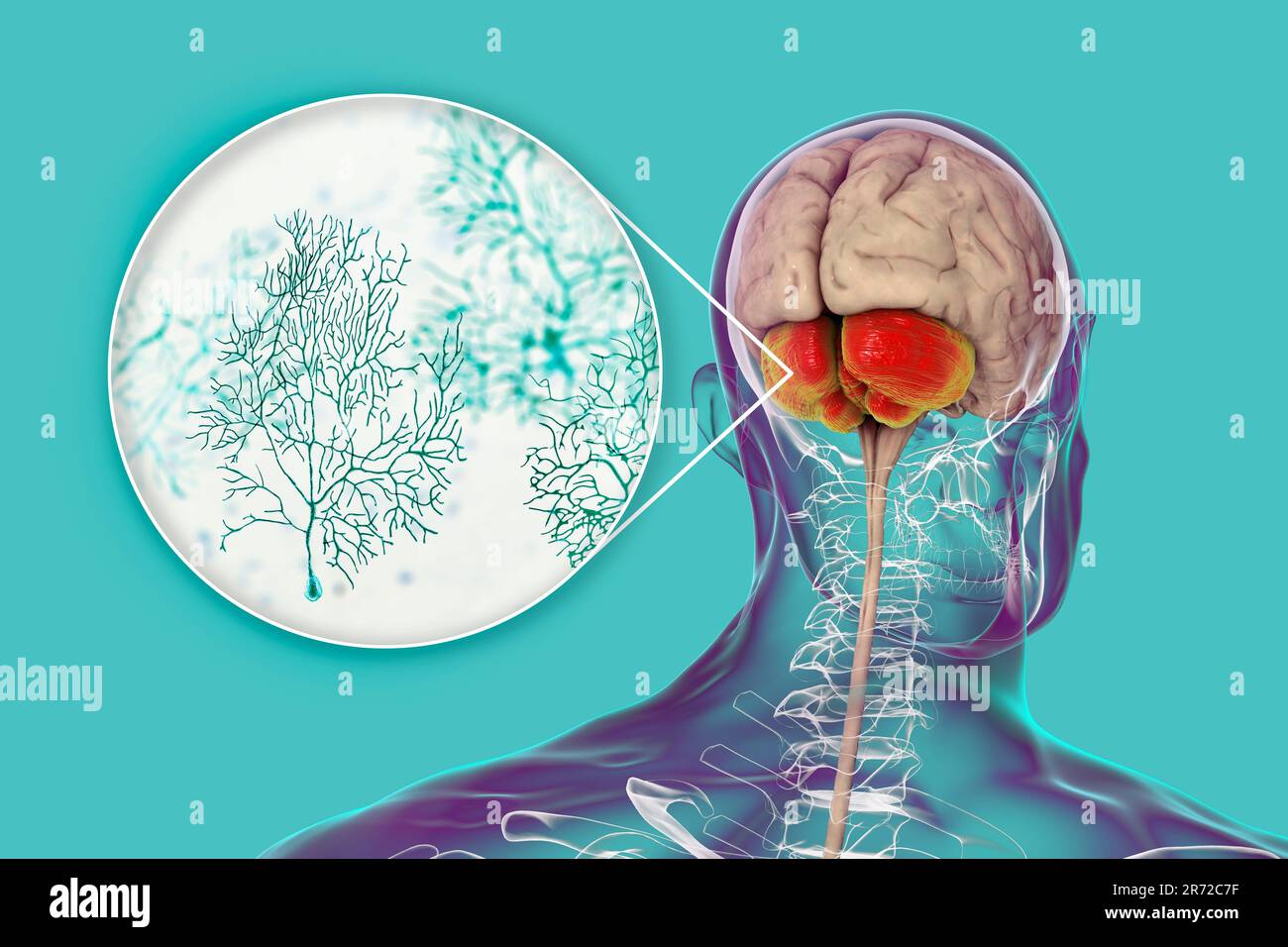 Nervenzellen des menschlichen Zerebellums und Purkinje, Illustration. Menschliches Gehirn mit hervorgehobelter Zerebellum-Ansicht und Nahaufnahme der Purkinje-Neuronen, eines der Commone Stockfoto