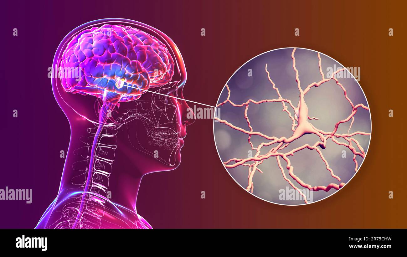 Substantia nigra. Computer zeigt eine gesunde substantia Nigra aus
