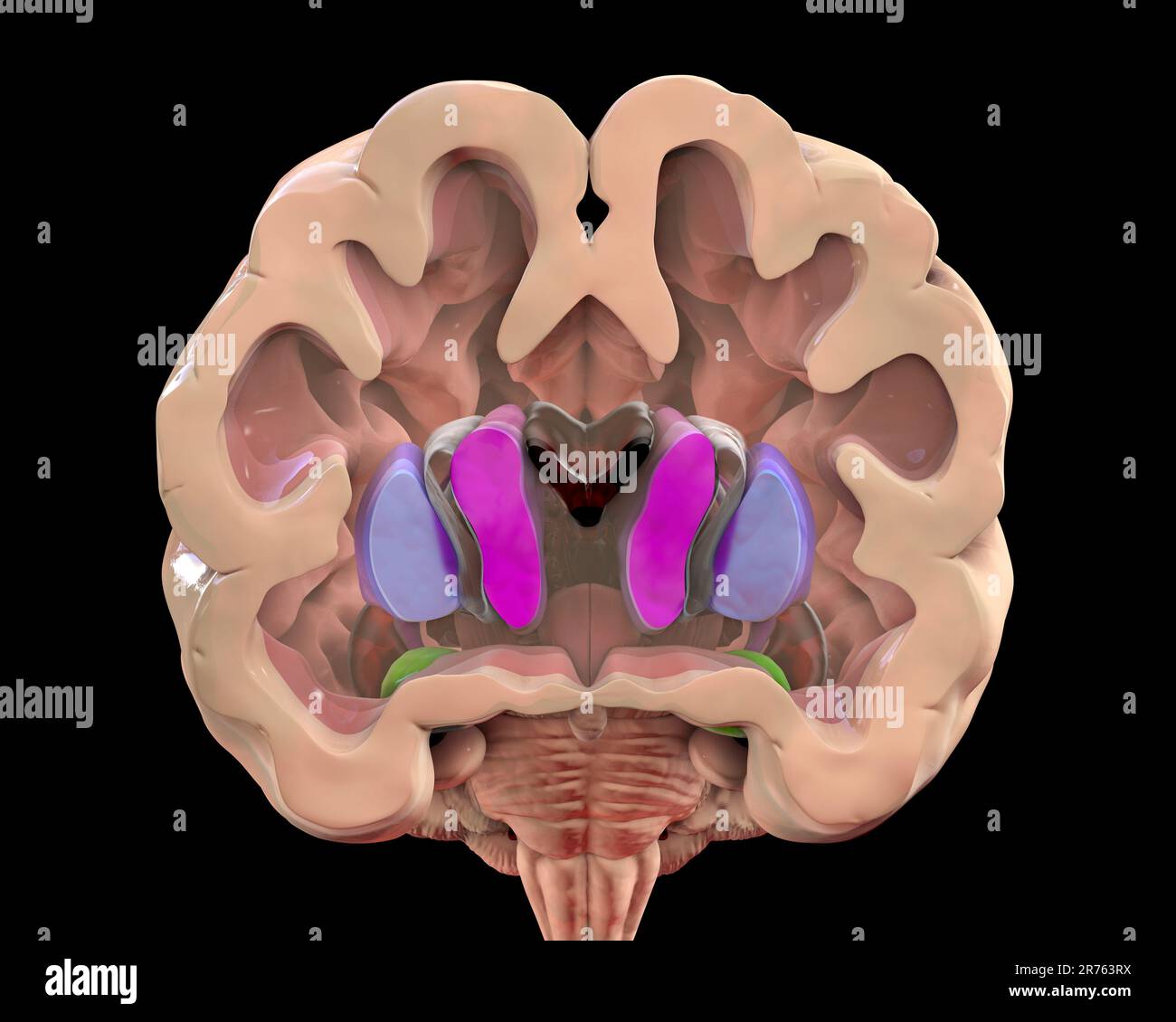 Computerdarstellung der Basalganglien mit Nucleus caudatus (violett), Putamen (blau) und lateralen Ventrikeln (dunkelrot). Stockfoto