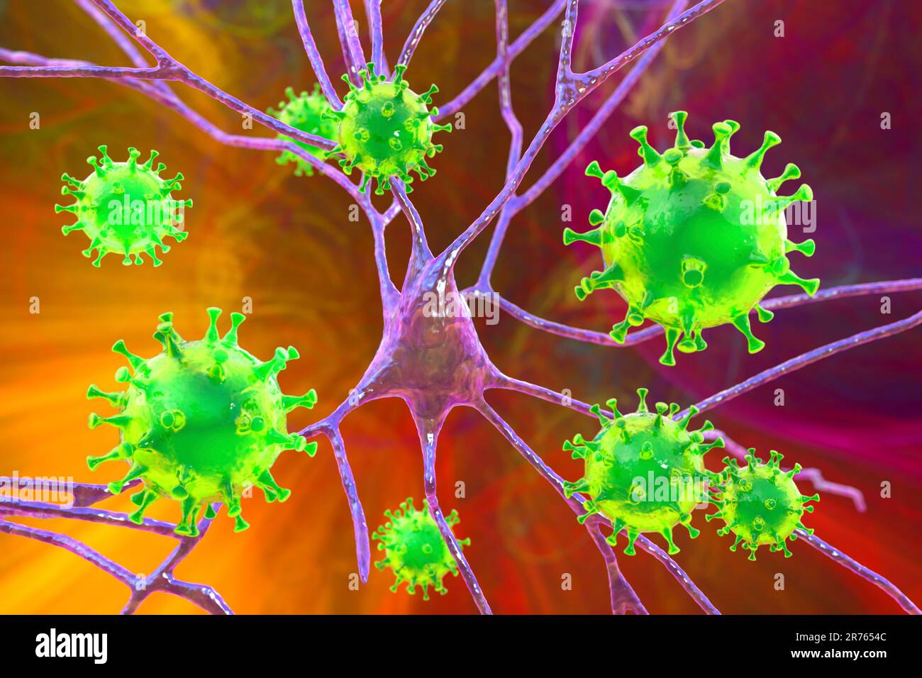 Virale Enzephalitis, konzeptionelle Illustration. Viren infizieren Nervenzellen. Stockfoto