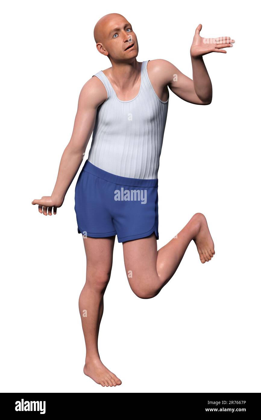 Eine Person mit Chorea Huntington, einer neurodegenerativen Erkrankung aufgrund einer Mutation im HTT-Gen, Veränderungen in den Basalganglien des Gehirns, die zu einer zufälligen Uncon führen Stockfoto