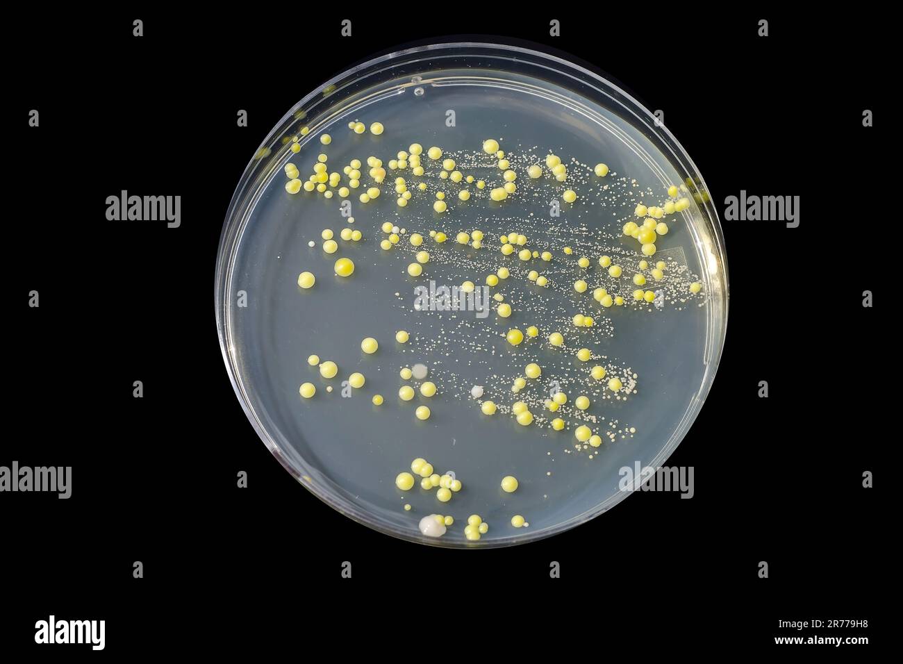 Bakterien aus Hautausstrich, Kolonien von Micrococcus luteus und ...