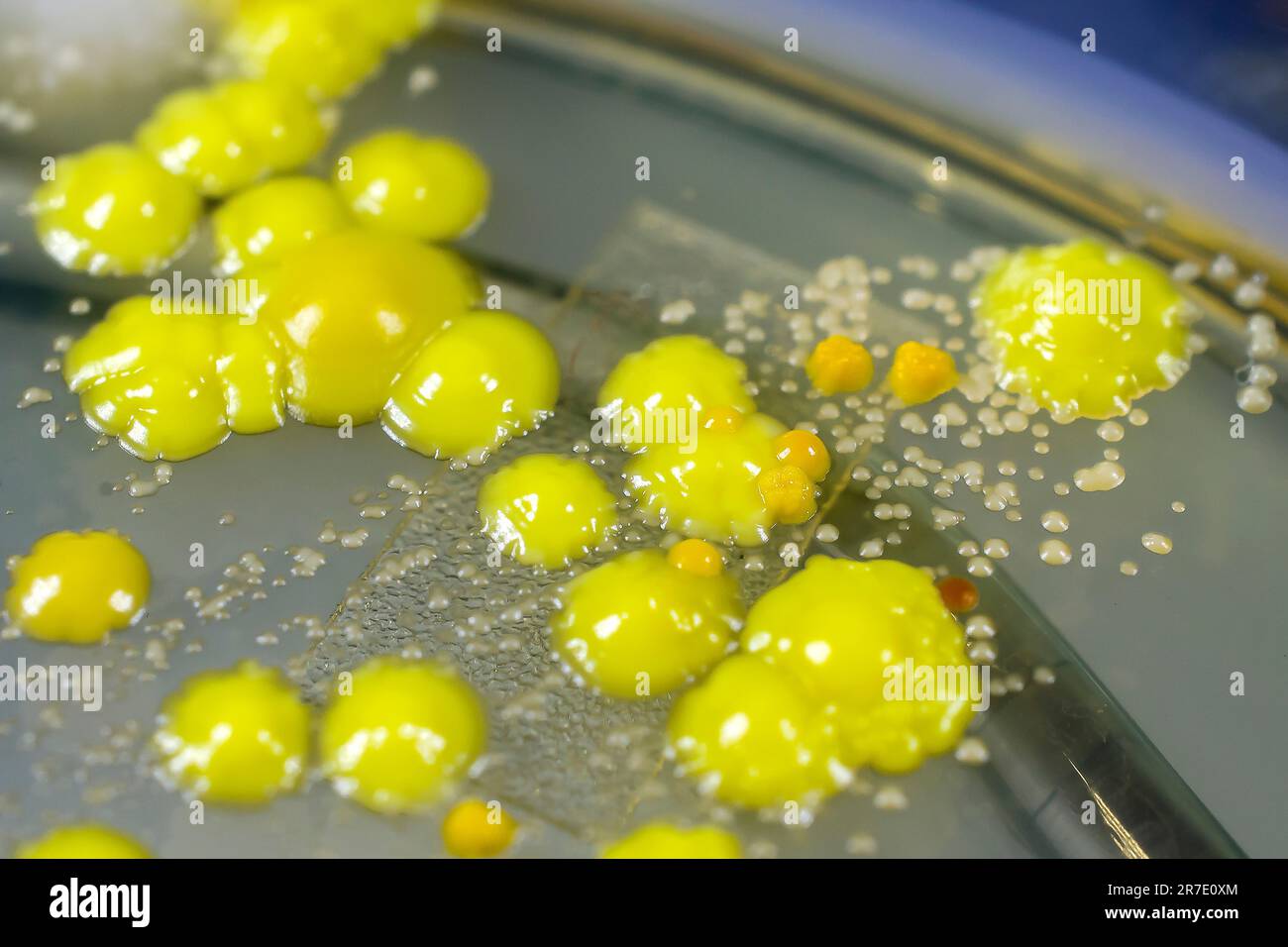 Bakterien aus Hautausstrich, Kolonien von Micrococcus luteus und Staphylococcus epidermidis auf Petrischale mit Nährmedium. Stockfoto