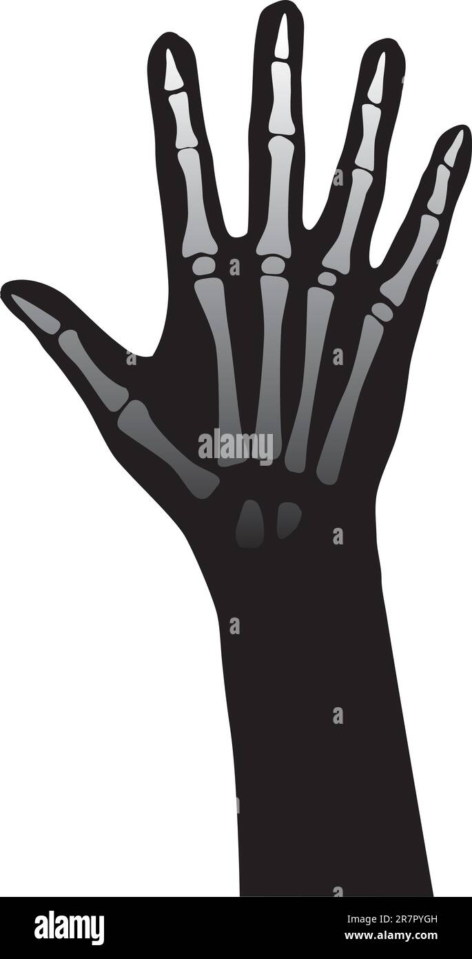 Offene Darstellung des Anatomievektors der Hand auf weißem Hintergrund Stock Vektor