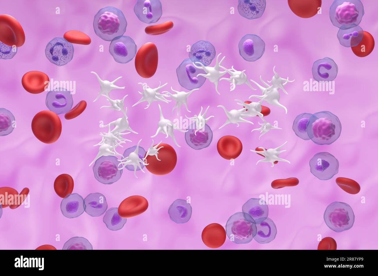 Essenzielle Thrombozythämie (ET), ein Blutkrebs durch Überproduktion von Thrombozyten - isometrische 3D-Darstellung Stockfoto