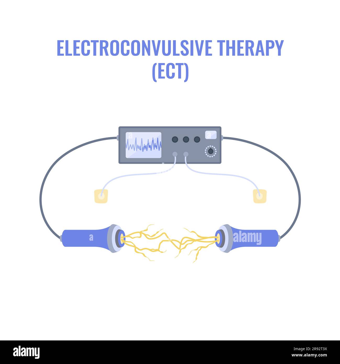 Elektrokrampftherapie, Illustration Stockfoto