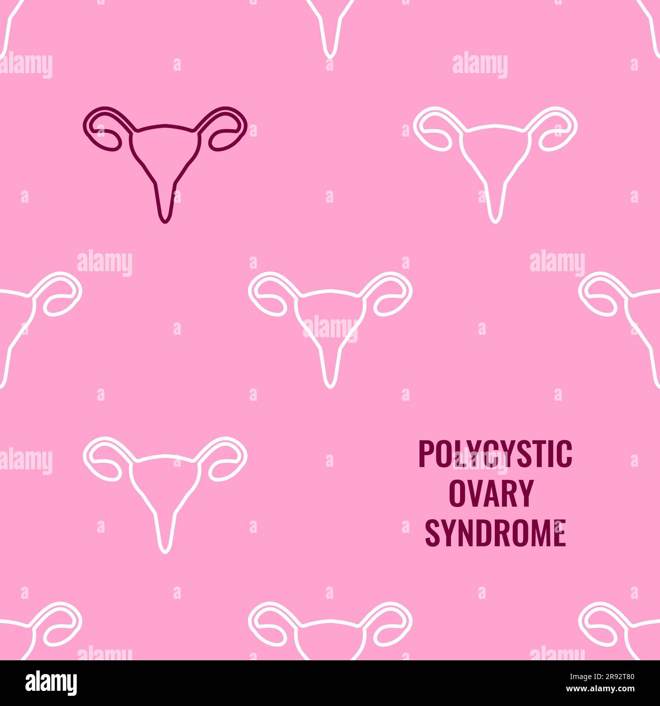 Polyzystisches Ovarialsyndrom Bewusstsein, konzeptionelle Illustration Stockfoto