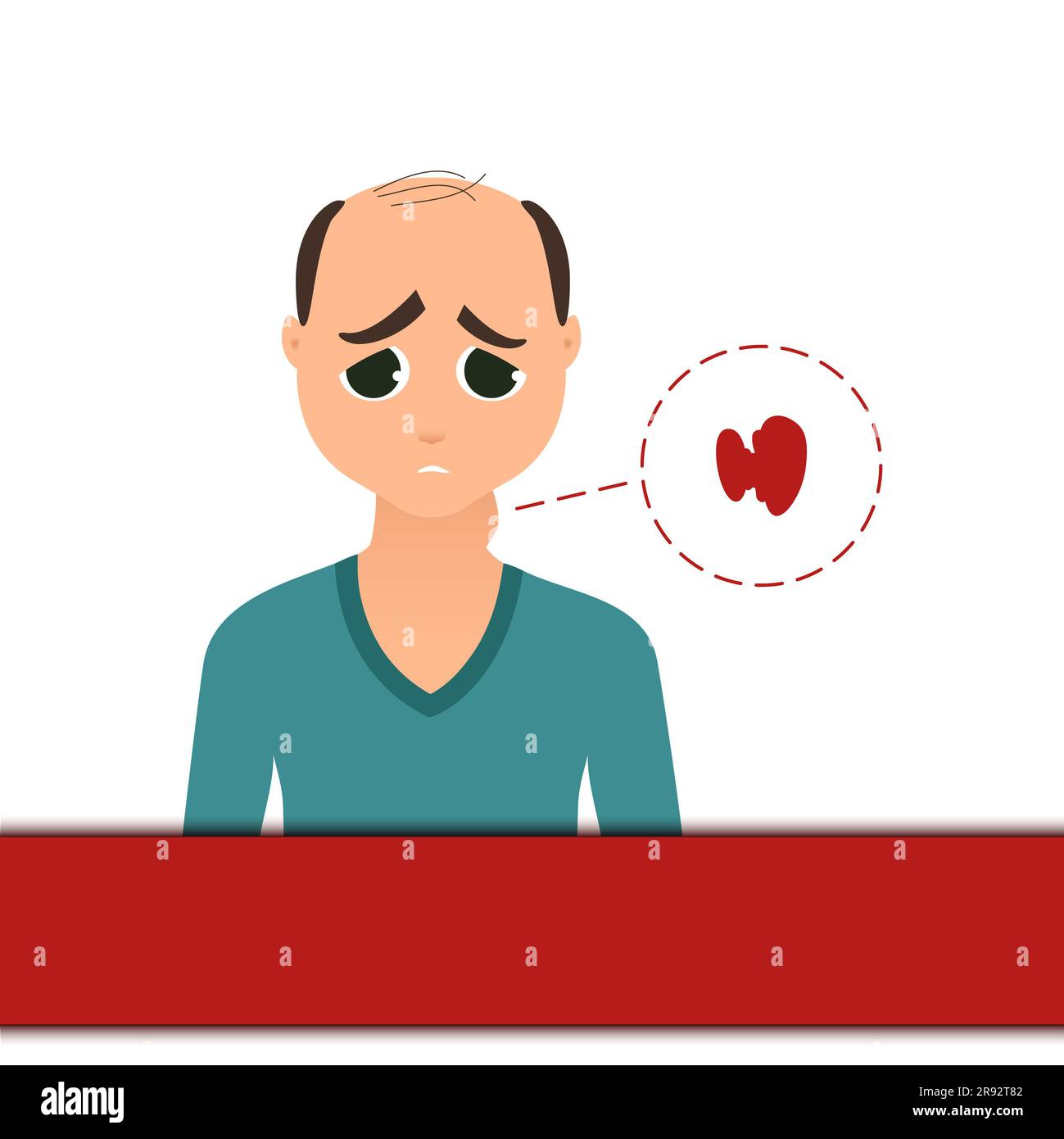 Schilddrüsenstörung, konzeptuelle Illustration Stockfoto