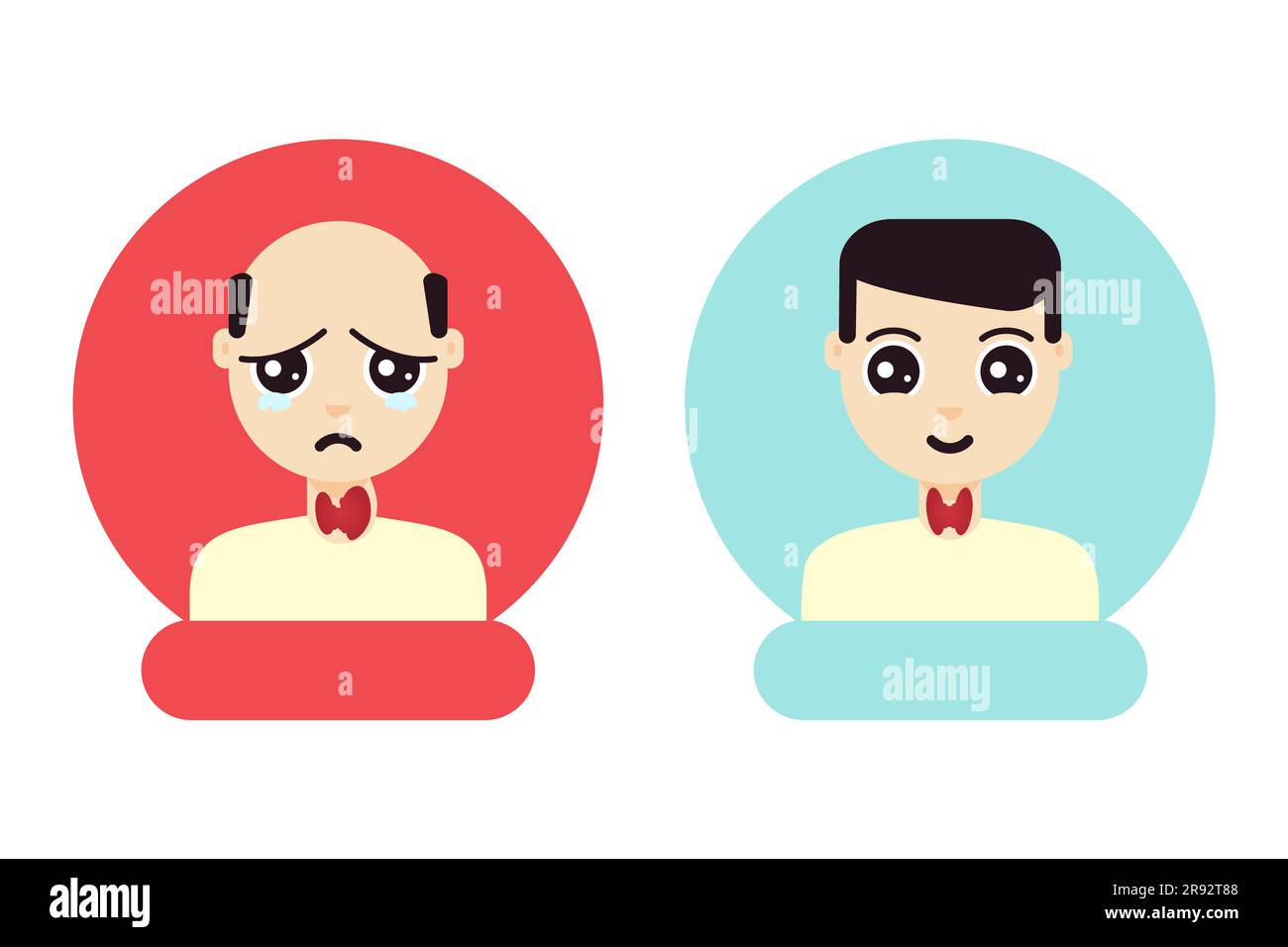 Hyperthyreose-Behandlung, konzeptionelle Illustration Stockfoto