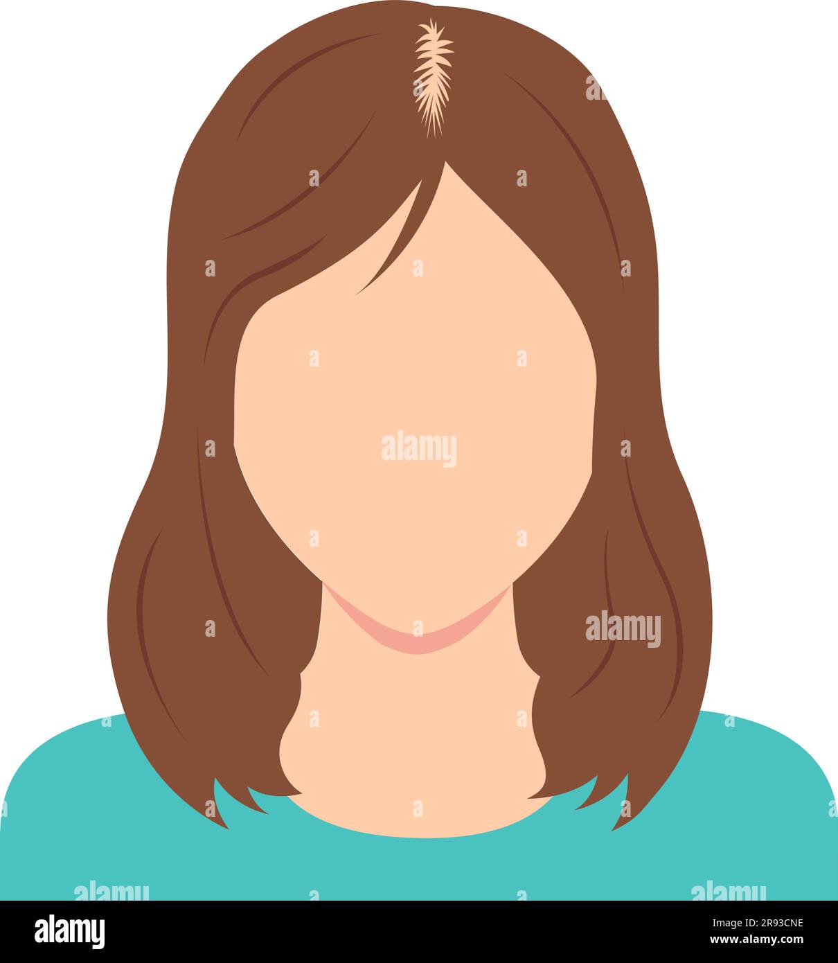 Weibliche androgenetische Alopezie Vektor-Illustration Stock Vektor
