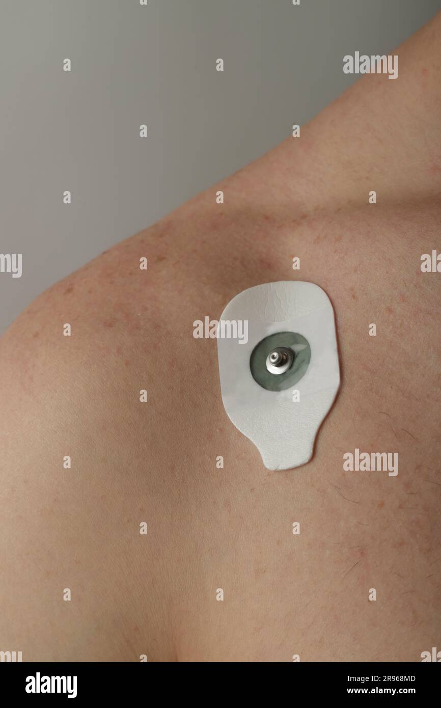 Detaildarstellung des Elektrokardiogramm-Saugers auf der Haut Stockfoto