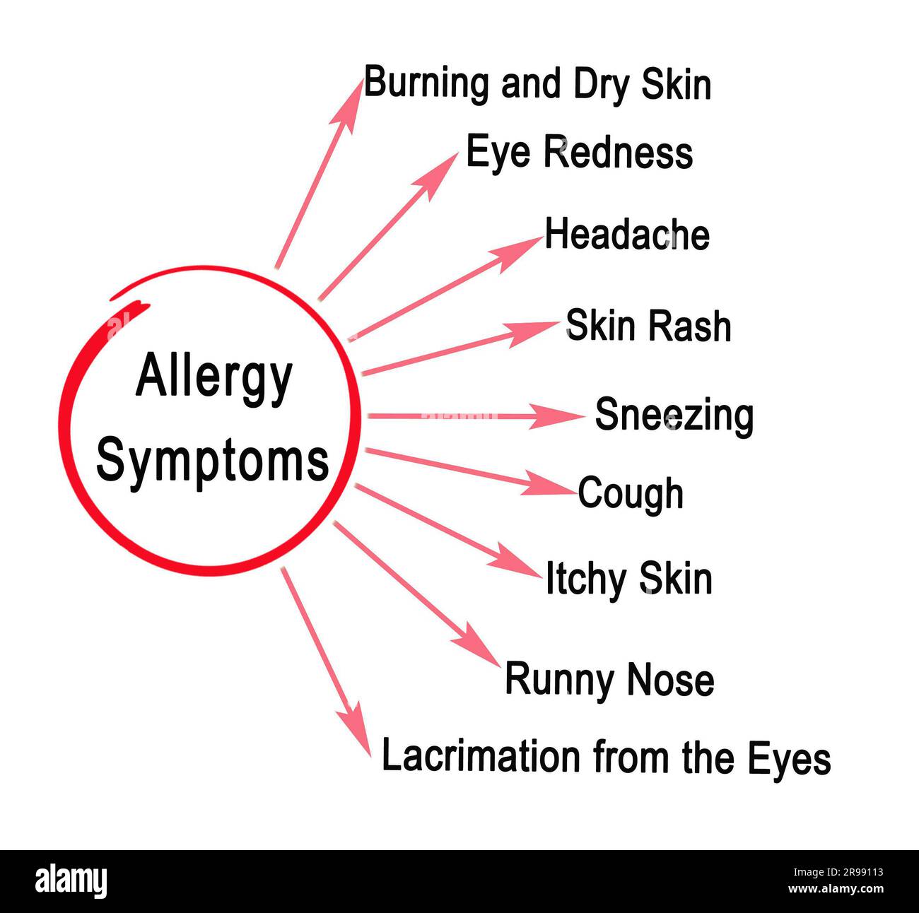 Neun Allergiesymptome Stockfoto