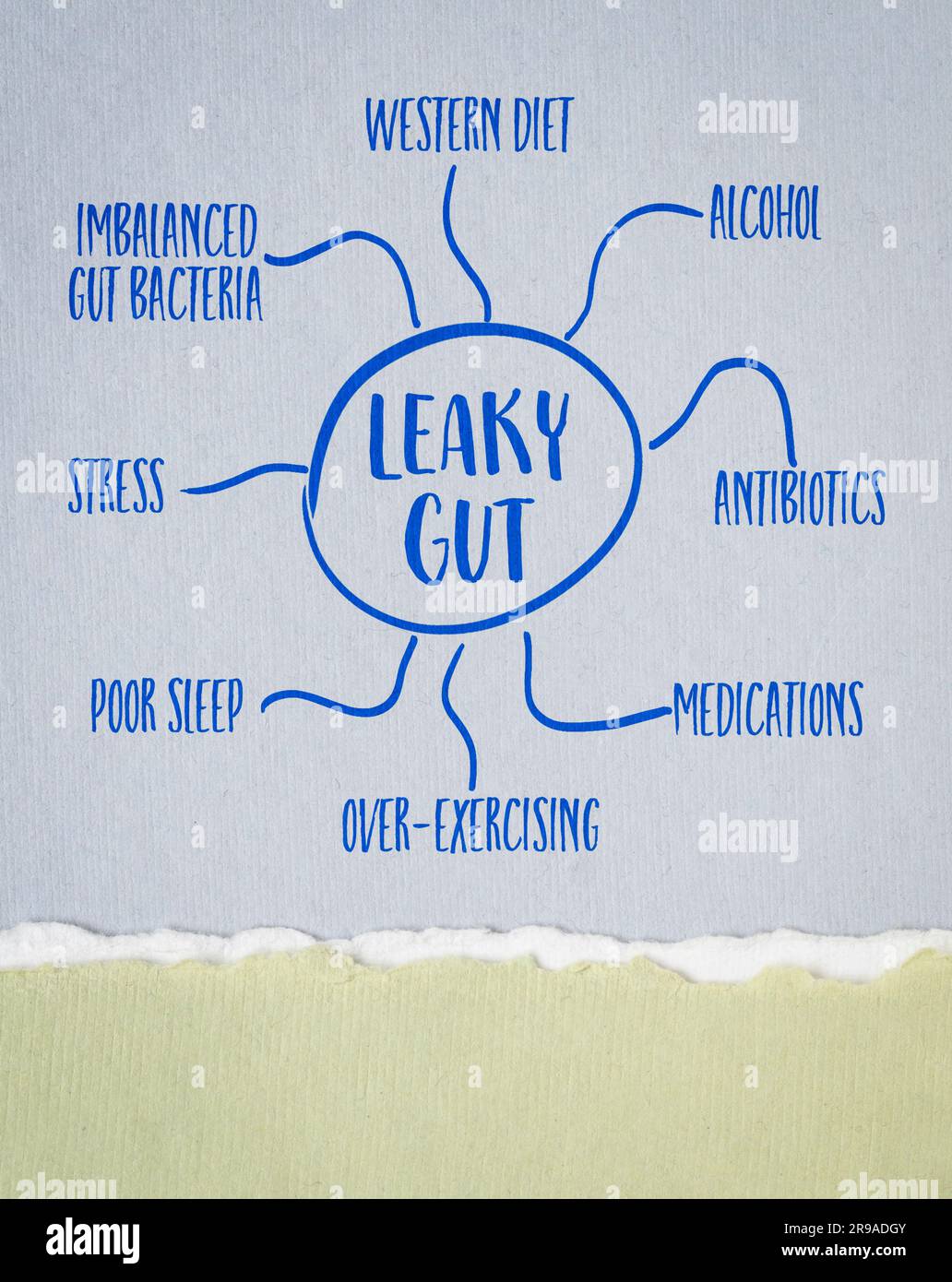 Ursachen des Leaky-Darm-Syndroms - Mindmap-Skizze auf Kunstpapier, Verdauungs-Gesundheitskonzept Stockfoto