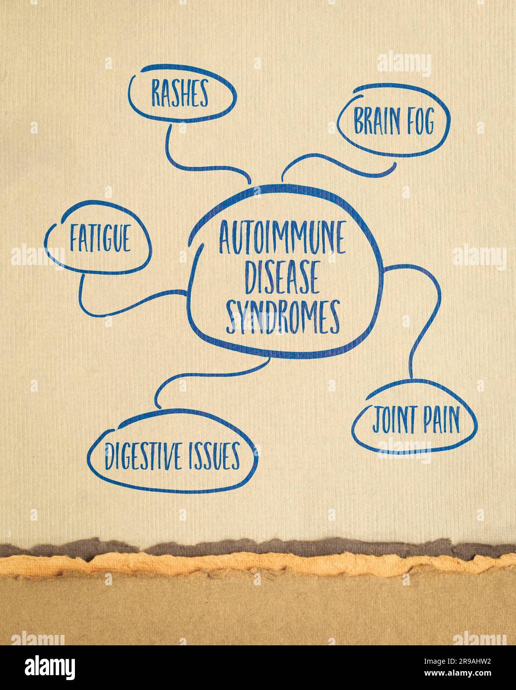 Autoimmunerkrankungen - Mindmap-Skizze auf Kunstpapier, Gesundheitskonzept Stockfoto