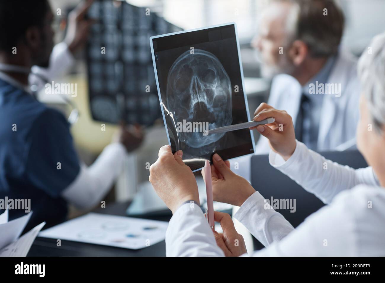 Die Hände einer jungen Assistentin und Radiologin diskutieren die Kopfhaut-MRT eines Patienten mit Schädel-Hirn-Trauma gegen zwei männliche Kollegen Stockfoto