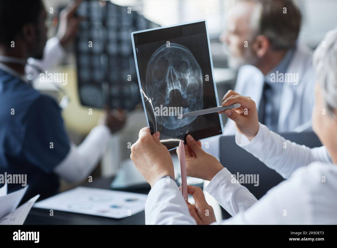 Schädel Hirn Trauma Patienten Bilder www.alamy.de