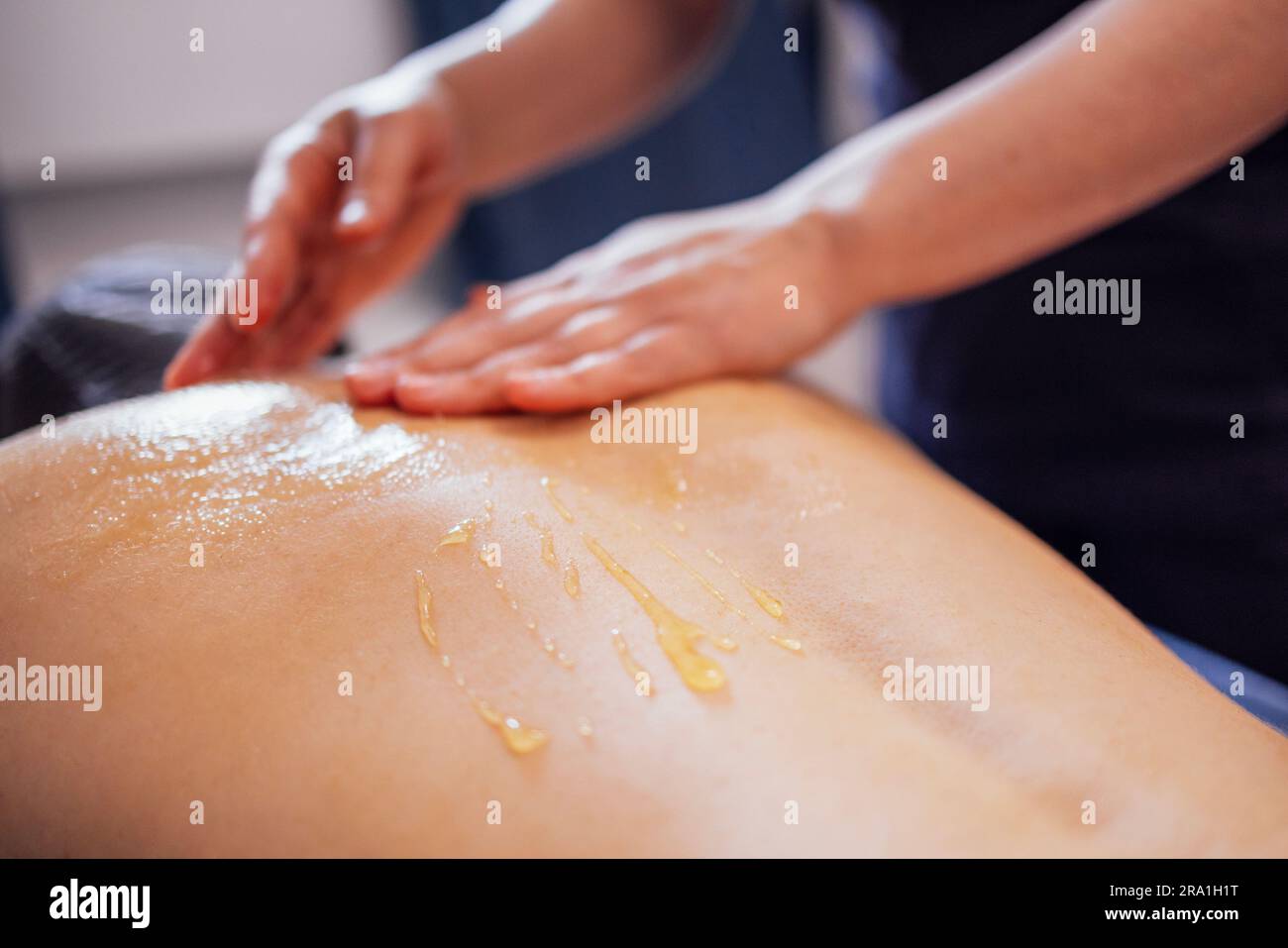 Massage des Halsbereichs mit Honig. Die Kundin liegt auf dem Tisch und bekommt eine Rückenmassage im Wellnesssalon oder in der Klinik. Nahaufnahme der ma Stockfoto