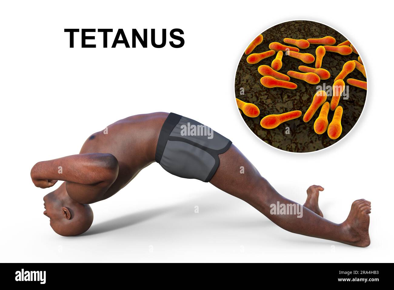 Clostridium tetani endospore Fotos und Bildmaterial in hoher