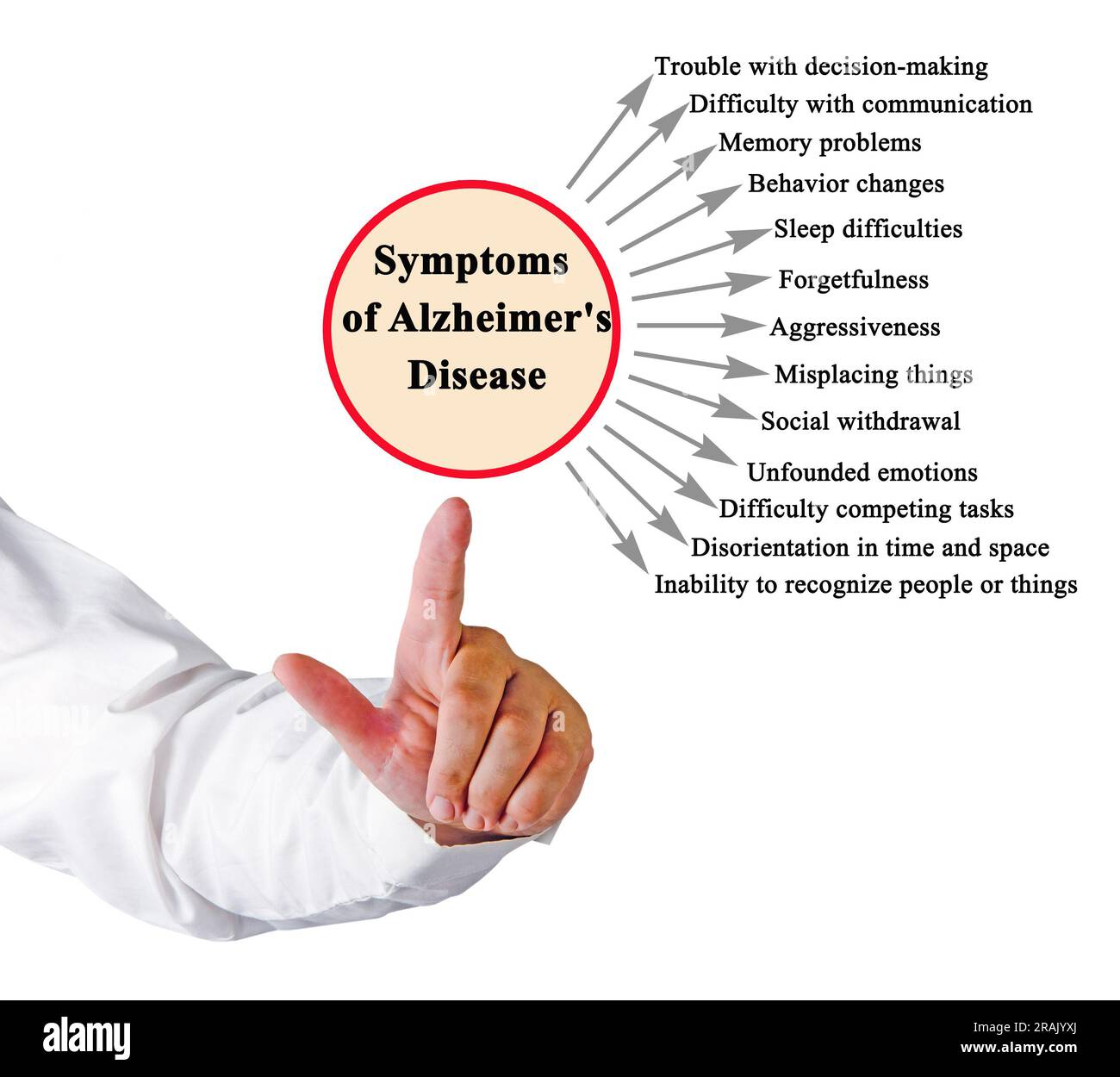 Leitsymptome der Alzheimer-Krankheit Stockfoto