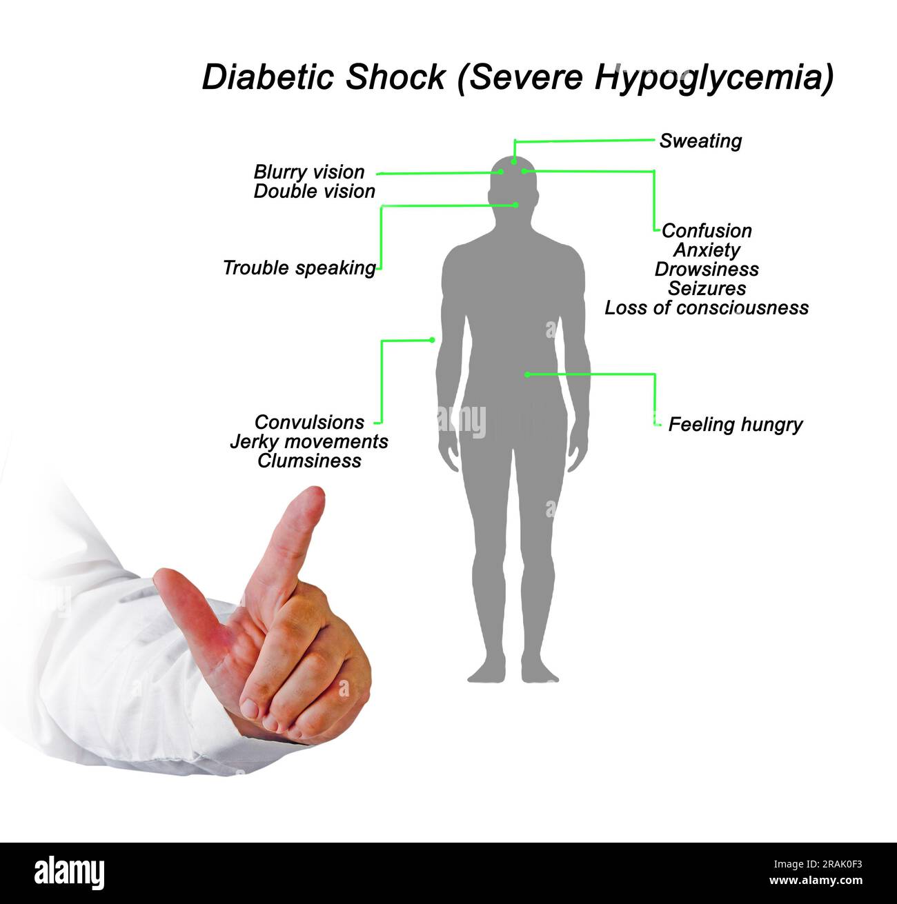 Diabetischer Schock (Schwere Hypoglykämie) Stockfoto