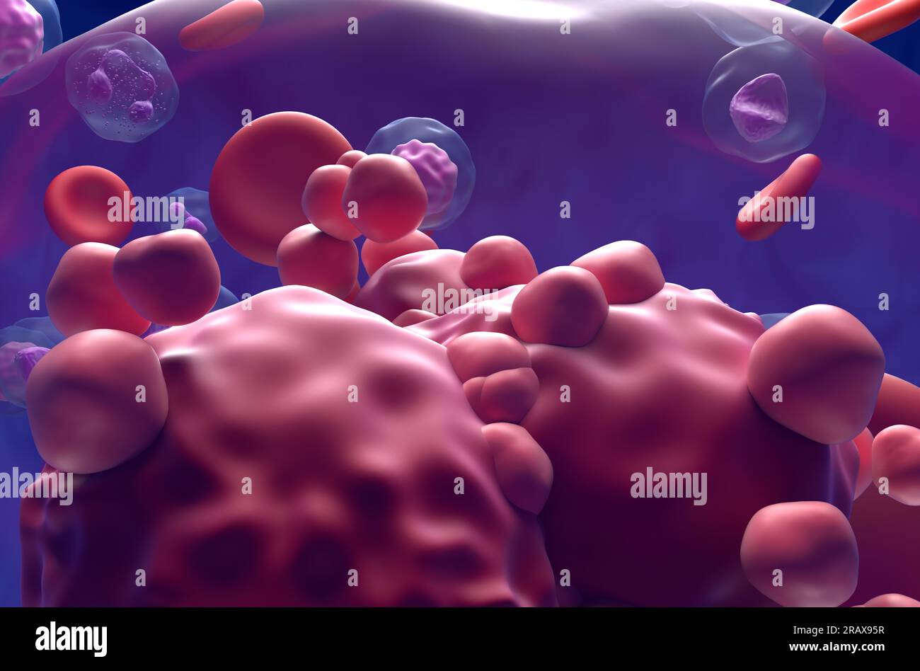 Akute lymphoblastische Leukämie (ALL) Krebszellen im Blutfluss - extra Nahaufnahme 3D Abbildung Stockfoto