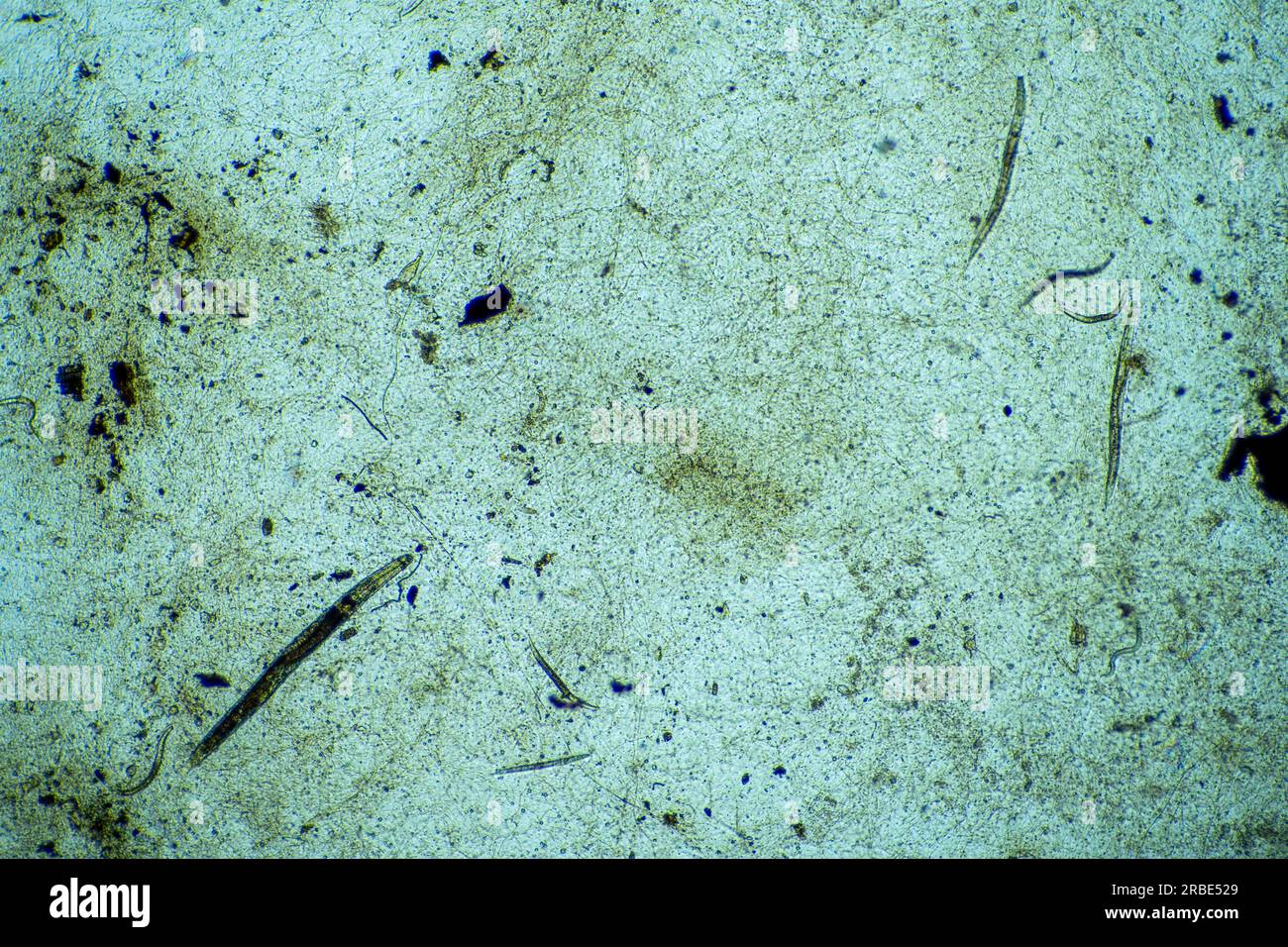 Nematoden unter dem Mikroskop im Labor Stockfoto