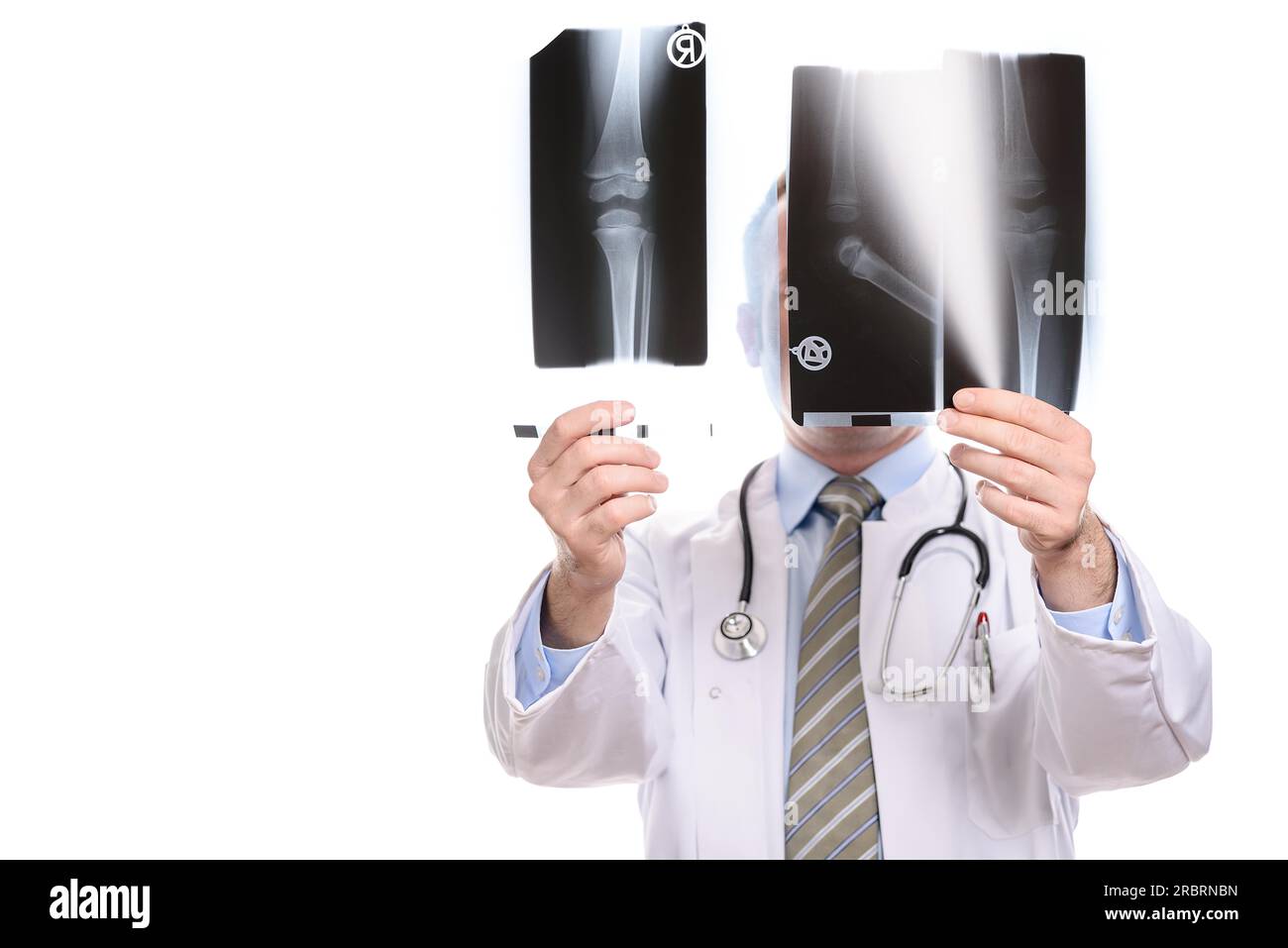 Männlicher Arzt, Radiologe oder orthopädischer Chirurg verglich zwei Röntgenstrahlen, die sie gegen das Licht halten, das sein Gesicht verdeckt, isoliert auf weiß Stockfoto