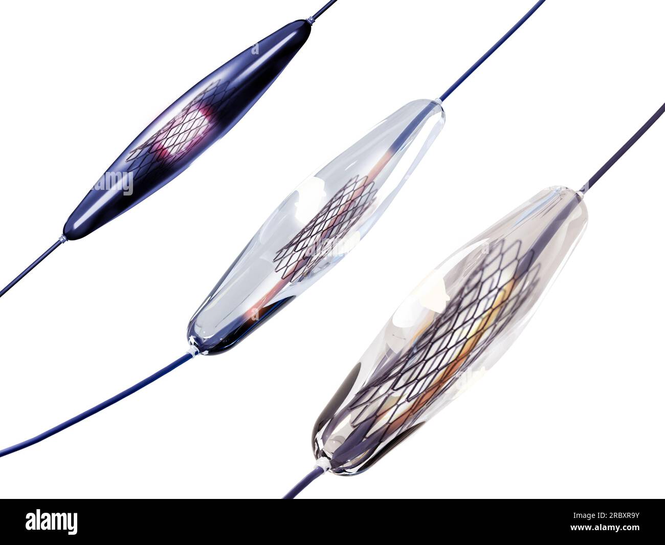 Selbstexpandierbares 3D-Rendering mit Mesh-Metall-Nitinol für endovaskuläre Operationen auf weißem Hintergrund. Beschneidungspfad. Stockfoto