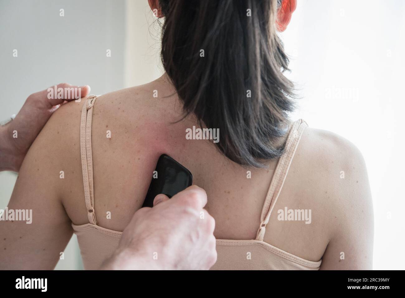 Junge Weiße, Die Eine Körperbehandlung Bekommt. Therapeut macht Hautkratztechnik. Chinesische Technik, Gua sha, zur Schmerzlinderung und -Behandlung Stockfoto