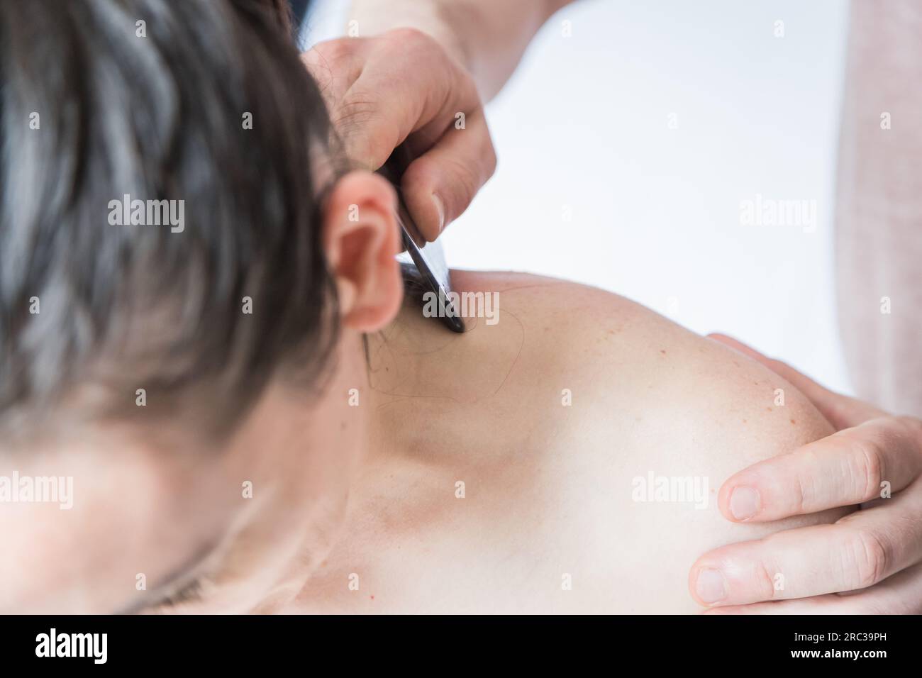 Junge Weiße, Die Eine Körperbehandlung Bekommt. Therapeut macht Hautkratztechnik. Chinesische Technik, Gua sha, zur Schmerzlinderung und -Behandlung Stockfoto