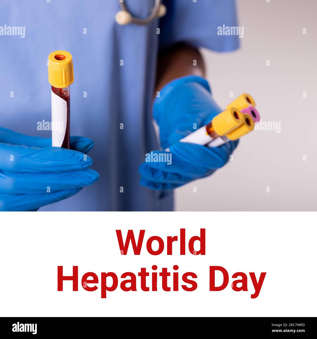 Zusammensetzung des World Hepatitis Day Text über birassische Arztinnen in Reagenzgläsern Stockfoto