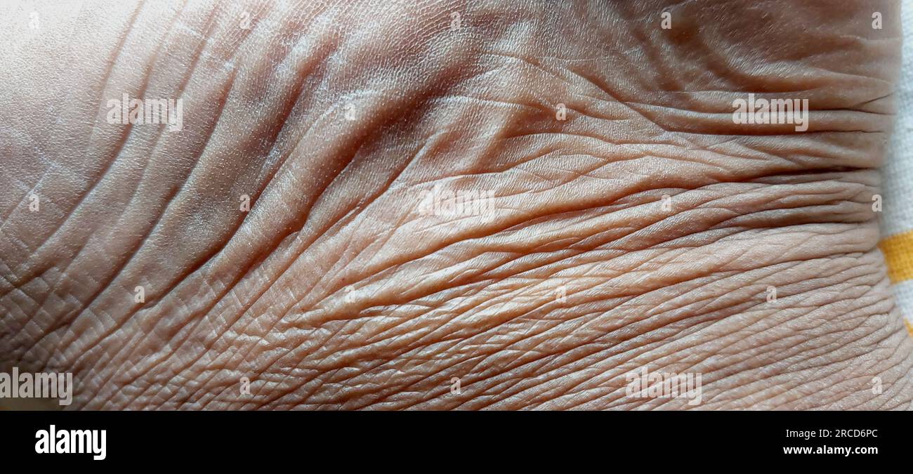 Die faltige Haut eines alten Mannes Stockfoto
