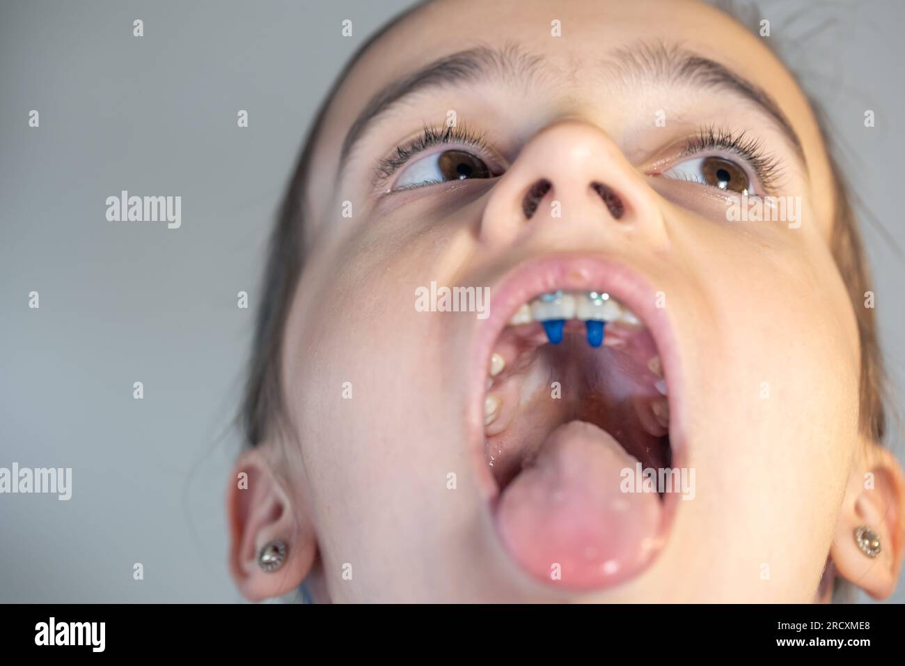 Frenulum -Fotos und -Bildmaterial in hoher Auflösung - Seite 2 - Alamy