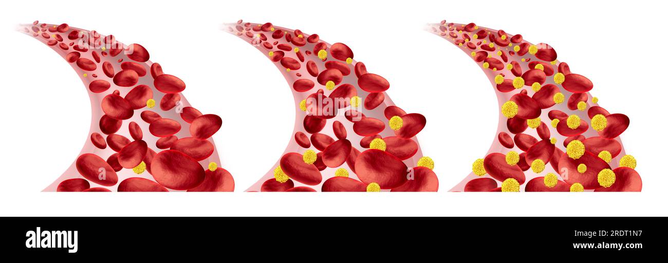 Blutzucker als Symbol für Hypoglykämie und Hyperglykämie oder normale Blutzuckerspiegel als Diabetes oder Diabetikersymbol als niedriger oder hoher Blutzucker Stockfoto