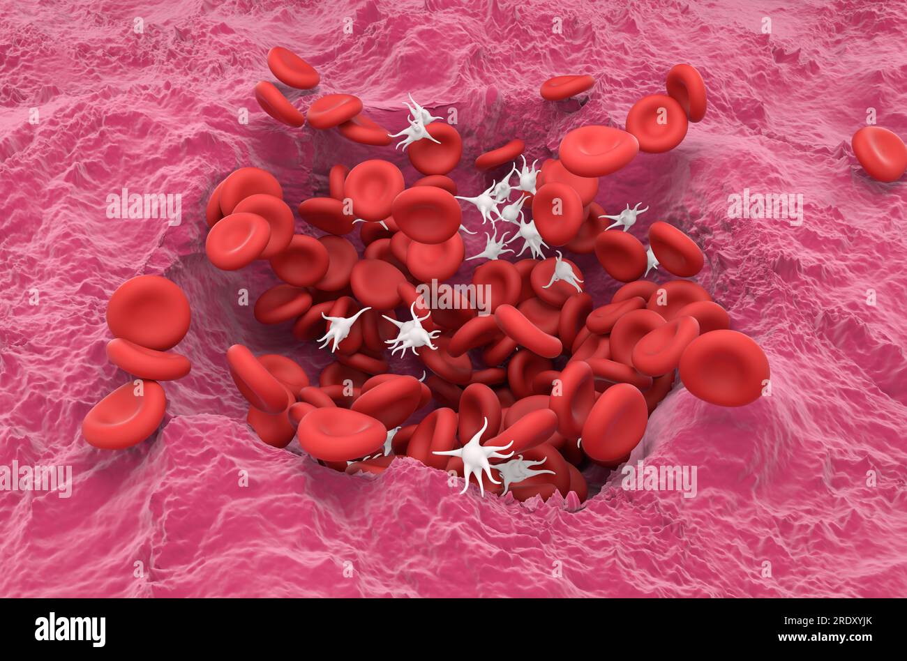 Erythrozyten und Thrombozyten in der heilenden Wunde - isometrische 3D-Darstellung Stockfoto