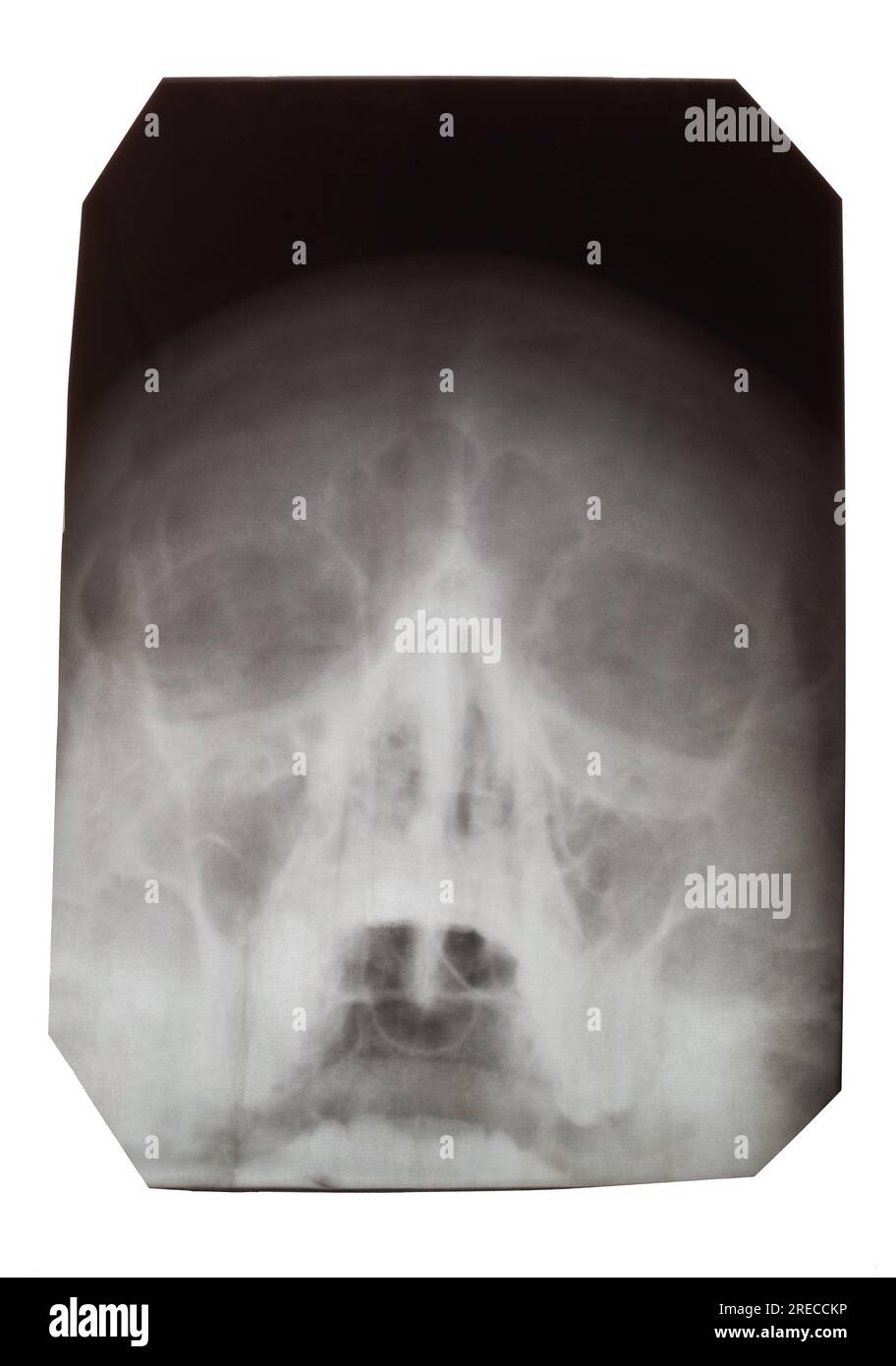 Anatomia del craneo -Fotos und -Bildmaterial in hoher Auflösung – Alamy