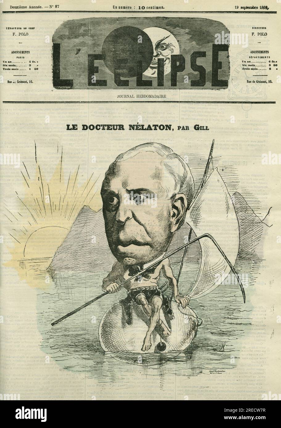 Auguste Nelaton (1807-1873), chirurgien francais. Couverture in 'L'Eclipse' par Gill, le 19 septembre 1869, Paris. Stockfoto